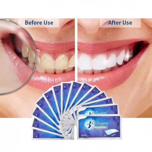 Bandes blanchissante dentaire