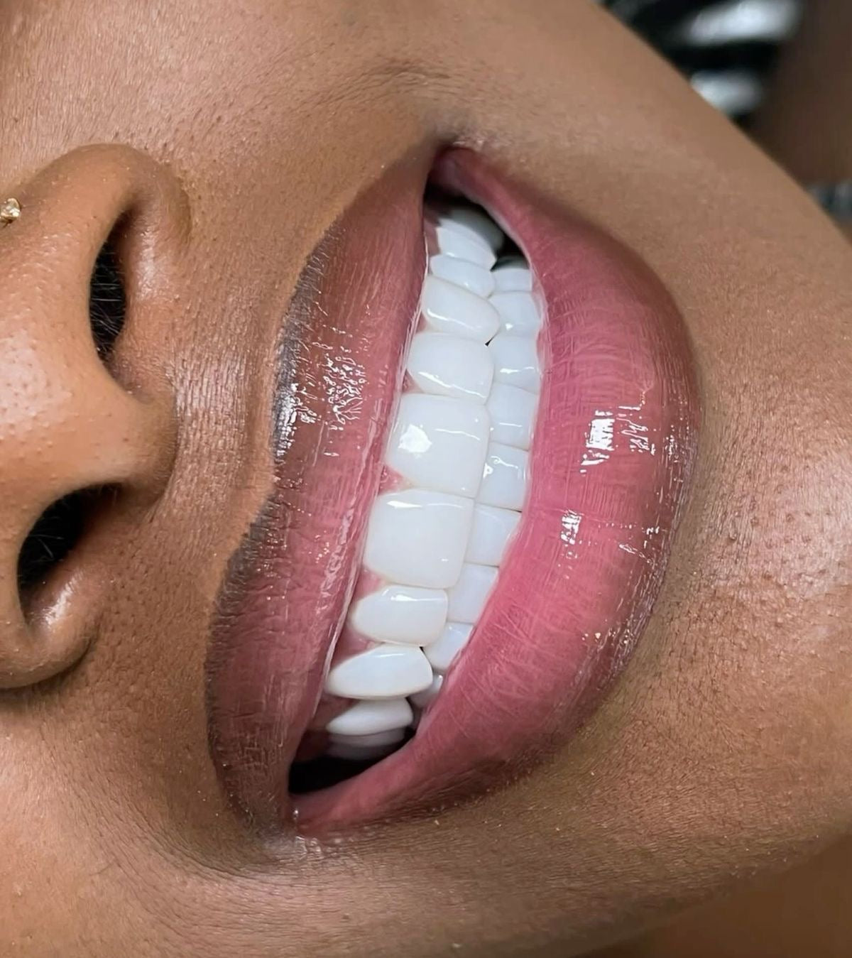 Soins Buccaux & Dentaires